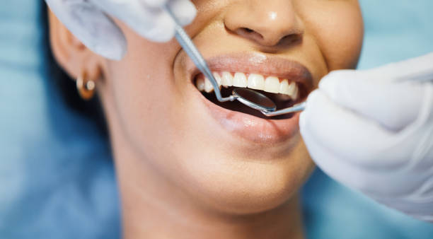 Best Emergency Dental Care for Sports Injuries in Monticello, KY