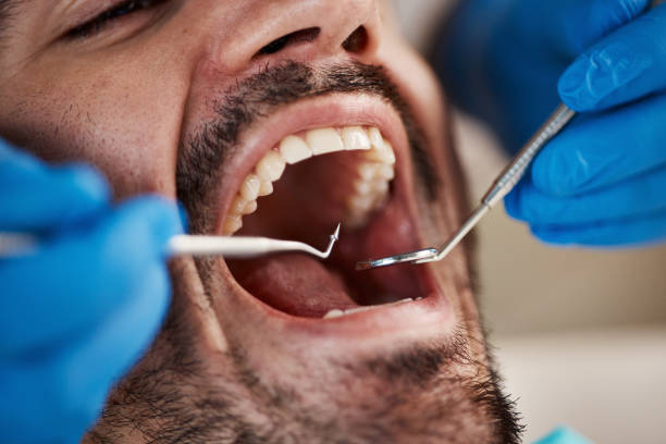 Best Emergency Cosmetic Dentistry (e.g., broken veneers) in Monticello, KY